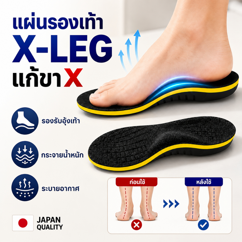 อุปกรณ์พยุงขา O/X สำหรับแก้ไขภาวะเท้าแบน แผ่นรองเท้าแบบนุ่ม