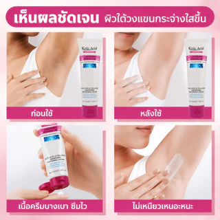 Kojic Acid ครีมบำรุงผิว 50ml ทารักแร้ ขาหนีบ เข่า คอดำ ปรับผิวให้ขาวกระจ่างใส