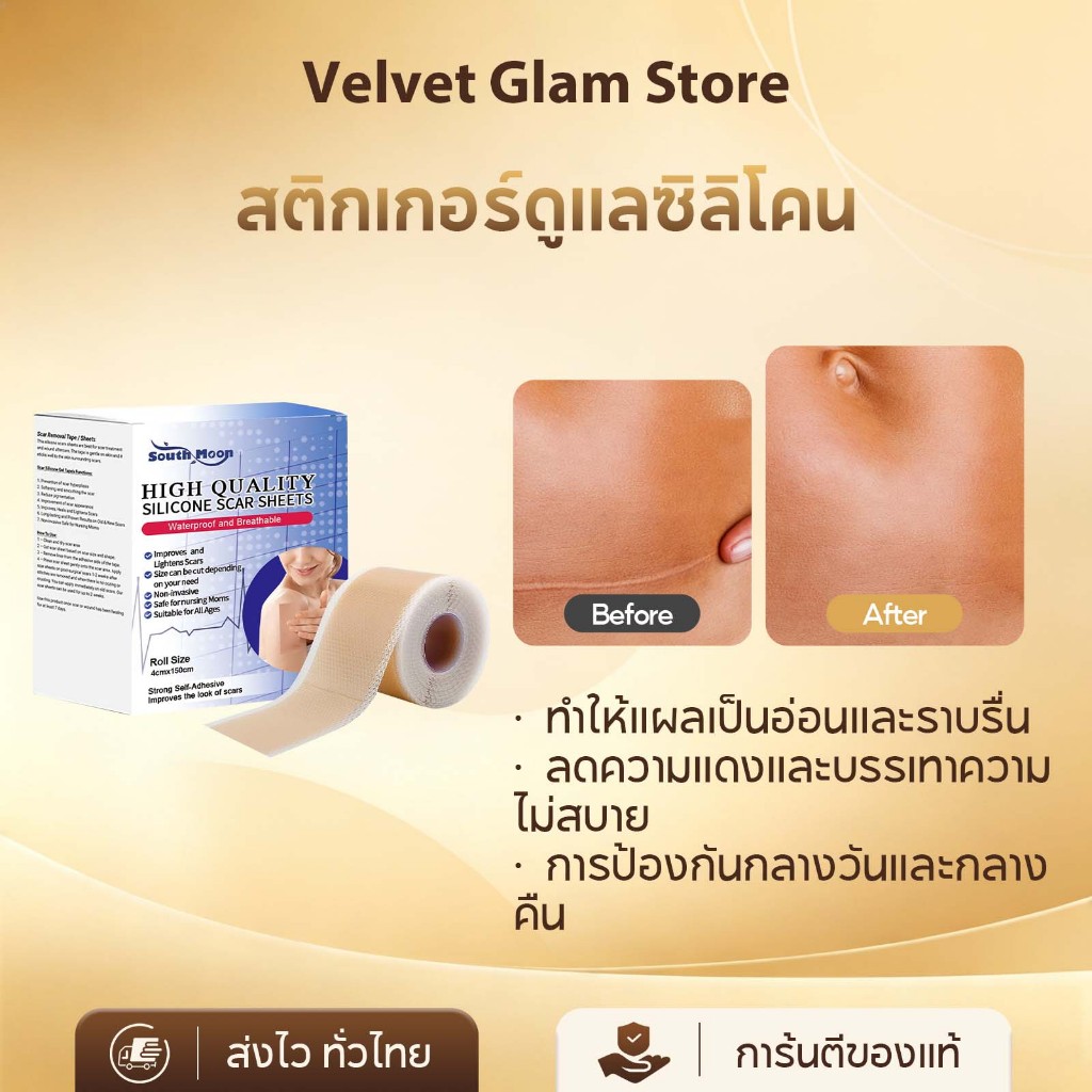 South Moon แผ่นซิลิโคนปิดแผลเป็น แผ่นแปะแผลเป็น แผ่นแปะลดรอย แผลคีลอยด์ แผลผ่าตัด Scar Sheet