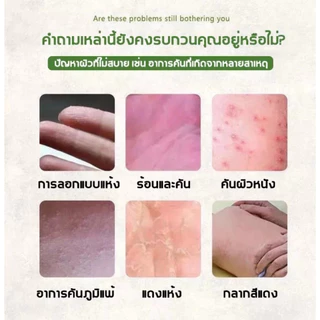 หยุดคันเร็ว ครีมแก้เชื้อรา ช่วยยับยั้งเชื้อรา บรรเทาอาการคันและผิวลอก เนื้อครีมบางเบา