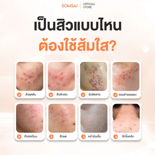 (ของแท้ 100%| แพ็ค 10) SOMSAI สบู่ล้างหน้าส้มใส 300ml หน้าใส ไร้สิว ปราศจากผิวติดสาร อ่อนโยนต่อผิว