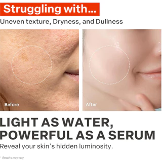 (🌼แท้ / พร้อมส่ง🌼) PURCELL L-Glutathione Vitamin Boosting Toner 150 ml