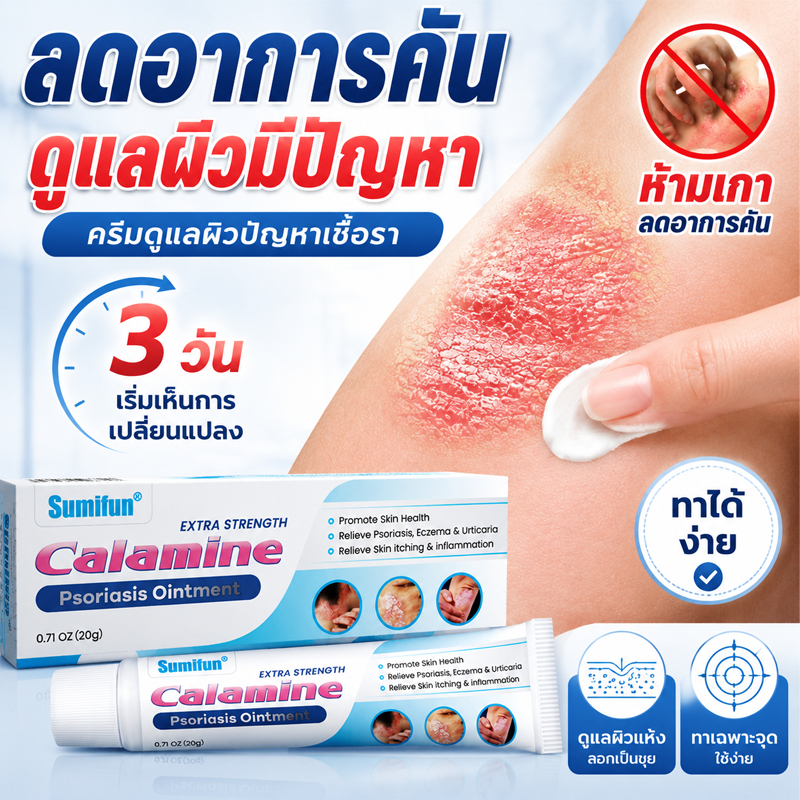 1 ครั้งเห็นผล ครีมลดอาการคัน สะเก็ดเงินครีม โรคผิวหนัง เกลื้อน กลาก คัน สมุนไพร แก้คันเรื้อรัง คันในร่มผ้า