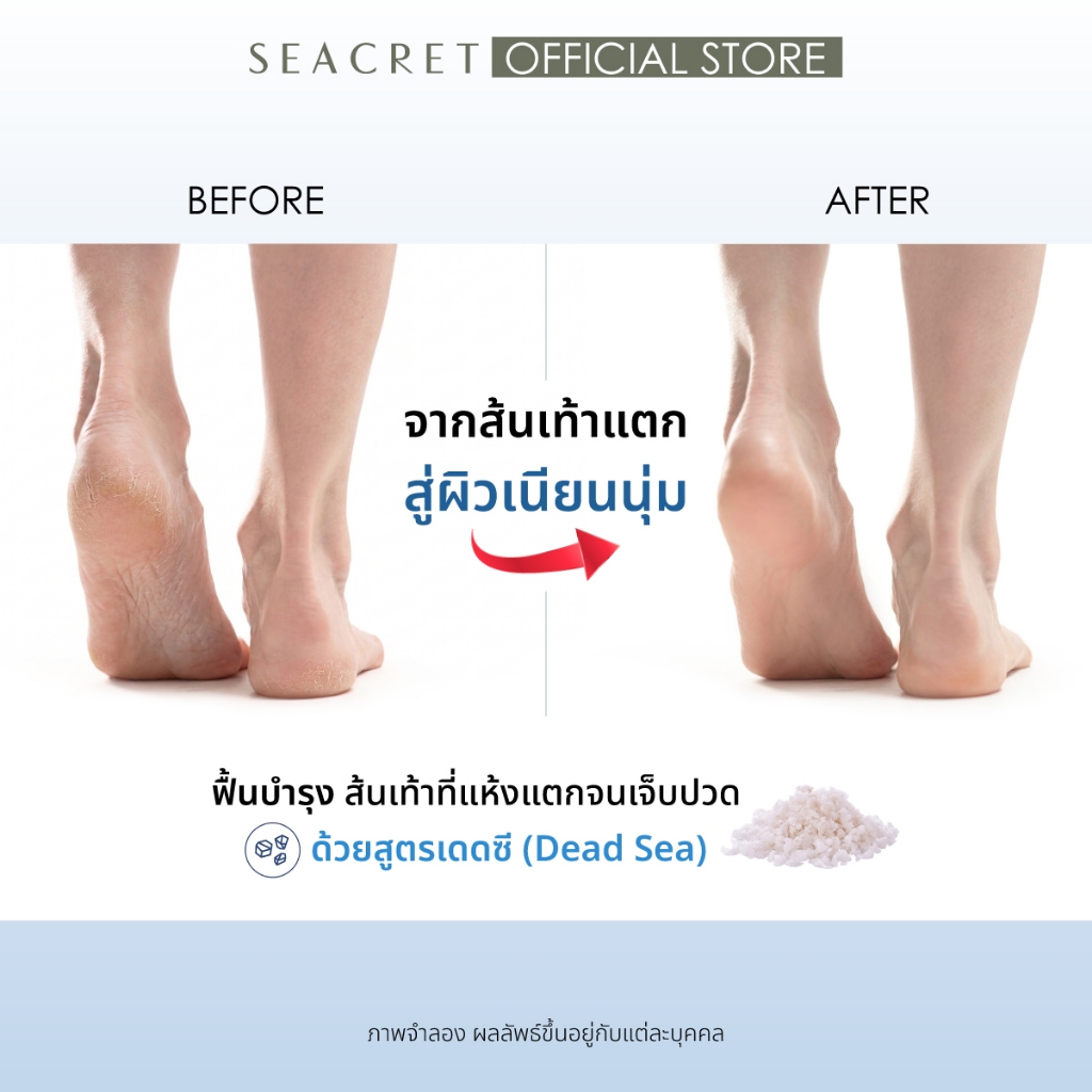 SEACRET طقم Pedi in a Bag للأظافر والقدمين — صورة 4