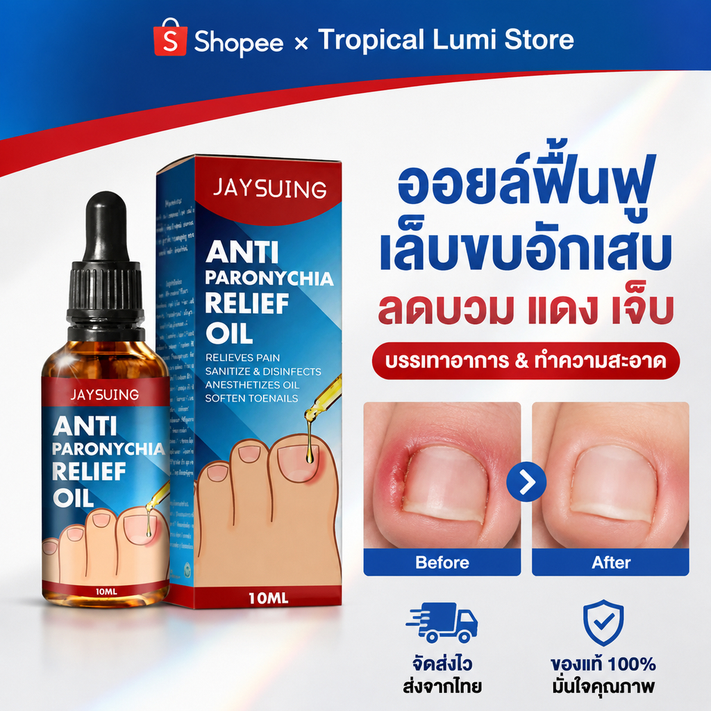 Jaysuing น้ำมันบำรุงเล็บ น้ำยาปรับเล็บขบ บำรุงเล็บแข็งแรง ใช้ได้ทุกวัน Removal paronychia oil