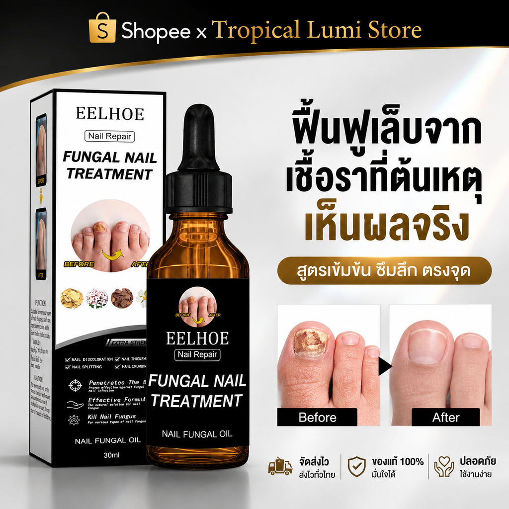 EELHOE เซรั่มบำรุงเล็บ น้ำยารักษาเชื้อราที่เล็บ กำจัดเล็บเสีย Nail Serum