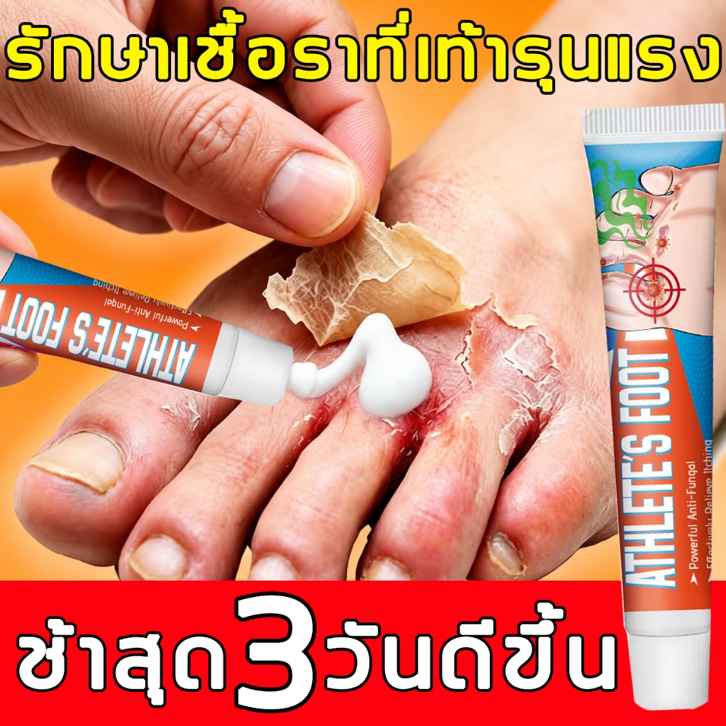 [หยุดคันทันที] ครีมระงับกลิ่นเท้า ครีมทาเท้า ลดอาการคันเท้า กลิ่นเท้า เชื้อราที่เท้า ซึมไว บำรุงผิวเท้า