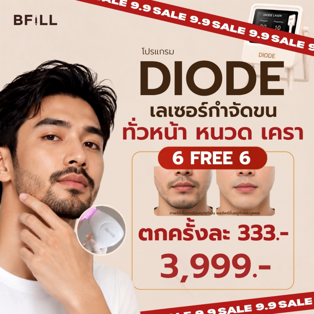 BFiLL โปรแกรม Diode Laser กำจัดขนทั่วหน้า หนวด เครา ลงลึกถึงรากขน ลดปัญหาขนคุด,ขนเป็นตอ เลเซอร์ขนบีฟิล
