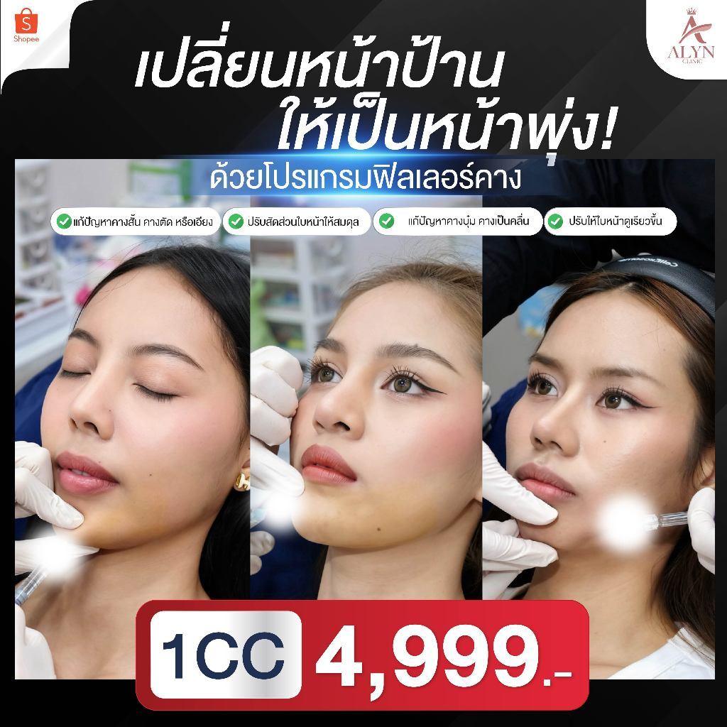 [ALYN Clinic] โปรแกรม ฟิลเลอร์คาง ฉีดคาง แก้คางสั้น คางตัด ปรับหน้าเรียว พุ่ง V-Shape