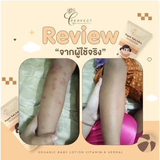 PERFECT Organic​ Baby​ Lotion​ โลชั่นเด็กออร์แกนิค บำรุงผิวขาวกระจ่างใส แก้ขาลาย ขนาด 100 ml​ หลอดเหลือง