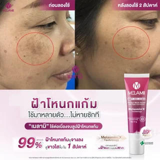 (1แถม1) ครีมทาฝ้ากระ จุดด่างดำ Melamii 8g. Exp 06/2027