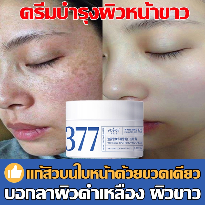 💖เหมาะสำหรับทุกสภาพผิว💖 AOFSE377 ก้ครีมแฝ้าผิวขาว ครีมกำจัดจุดด่างดำ ทาผิวขาว แก้ฝ้าบนหน้า วามชุ่มชื