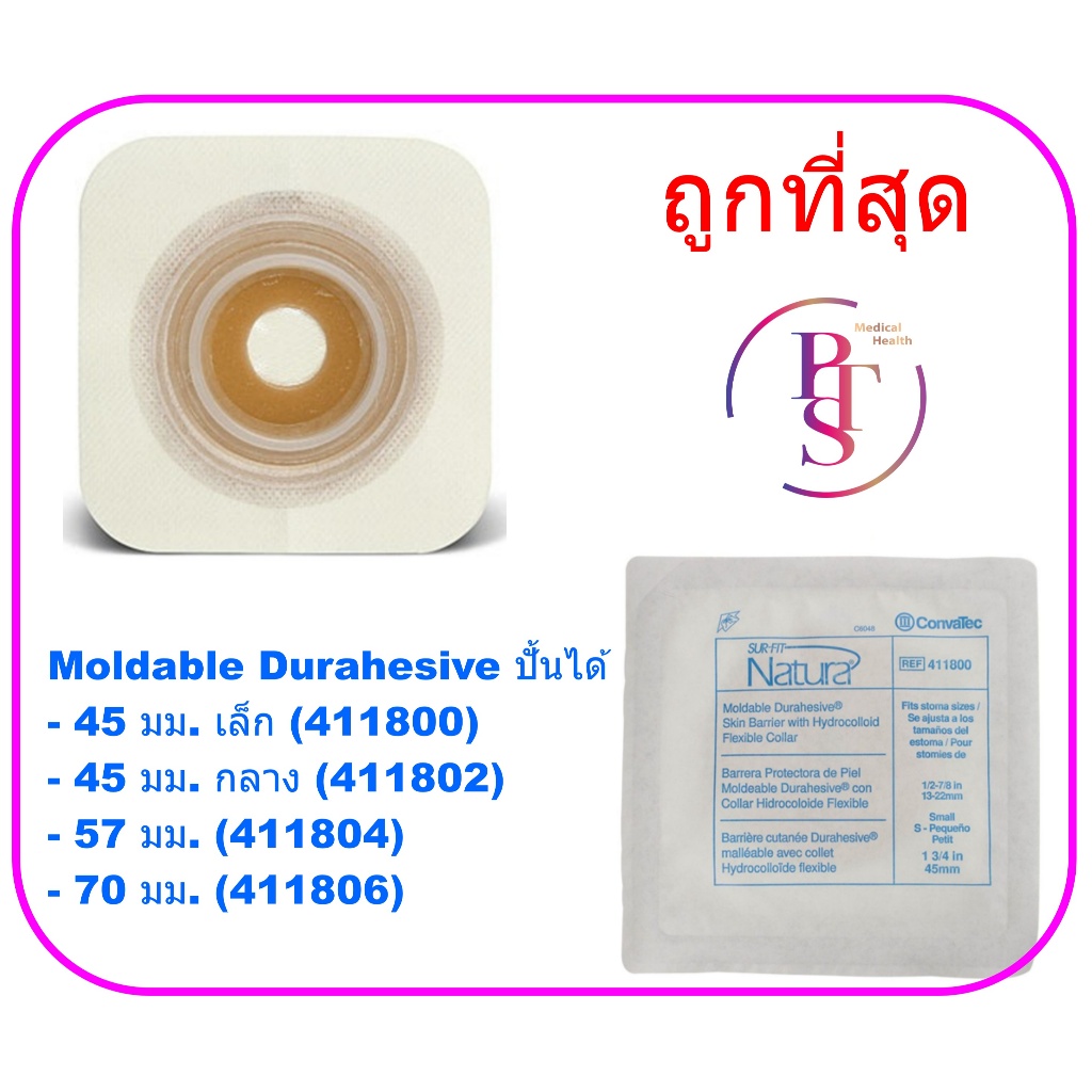 Convatec Flat Moldable แป้นแบบปั้นแต่งได้ แผ่นแป้นปิดรอบลำไส้ (Colostomy Flange) (ราคาต่อ 1 ชิ้น)