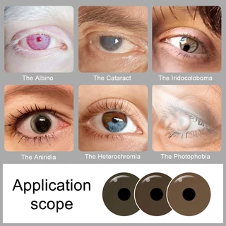 【COD】เลนส์เทียม Prosthetic Lens สำหรับตาบกพร่อง | ใช้ 6 เดือน | คอนแทคเลนส์เทียม 2 ชิ้น