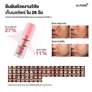 [2 ขวด ฟรีของแถม] เซรั่มสูตรใหม่! Gen2 Dr.PONG MC1 melas clear activein serum เซรั่มลดเลือนฝ้า กระ จุดด่างดำ