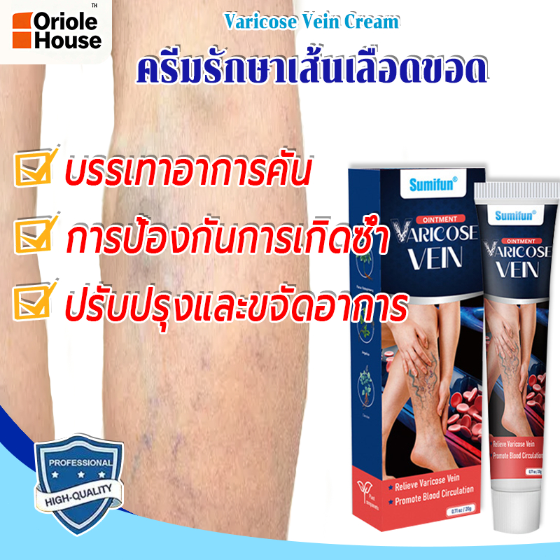 รักษาขาให้สวย ครีมรักษาเส้นเลือดขอด ส่งเสริมการไหลเวียนโลหิต บรรเทาอาการปวด ขนาด20กรัม เส้นเลือดขอด ครีมทาเส้นเลือดขอด