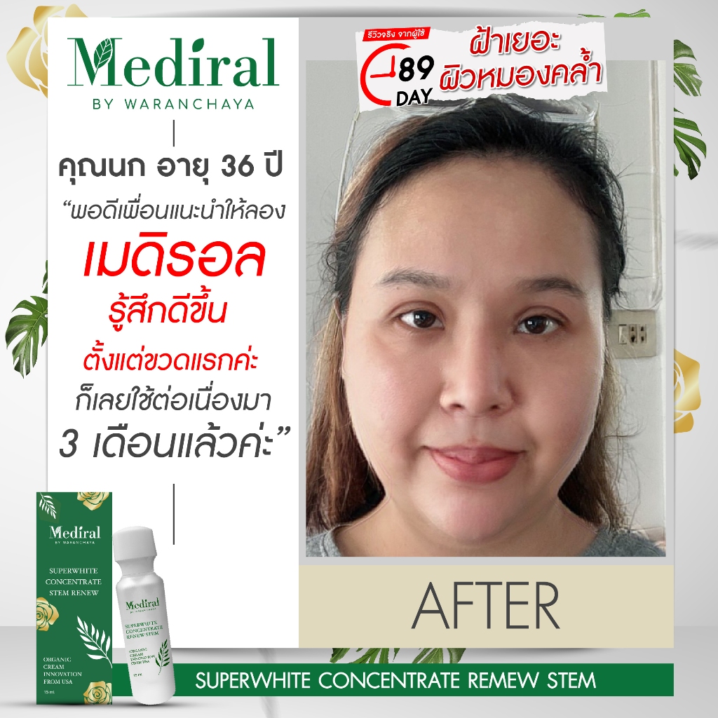 (ส่งฟรี ส่งไว!) Mediral Super White สูตรเร่งด่วน ช่วยลดฝ้า กระ รอยสิว ผิวใสขึ้นใน 7 วัน ราคา ถูกที่สุด ดีลบีเคเค แกลเลอรีภาพที่ 7