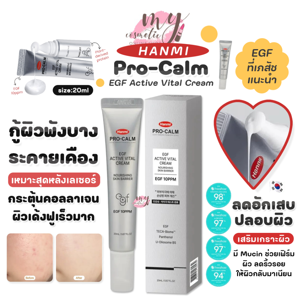 (🌼แท้ / พร้อมส่ง🌼) Hanmi Pro-Calm EGF Active Vital Cream 20ml
