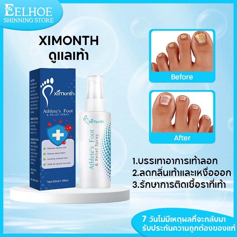 Ximonth สเปรย์ดูแลเท้า สเปรย์บรรเทาอาการเชื้อราที่เท้า ลดกลิ่นอับเท้า ช่วยให้เท้านุ่มและสดชื่น