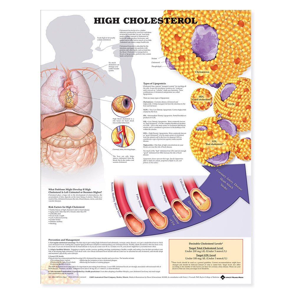 แผ่นโปสเตอร์ High Cholesterol Anatomical Chart (Paper) ed 1/2005