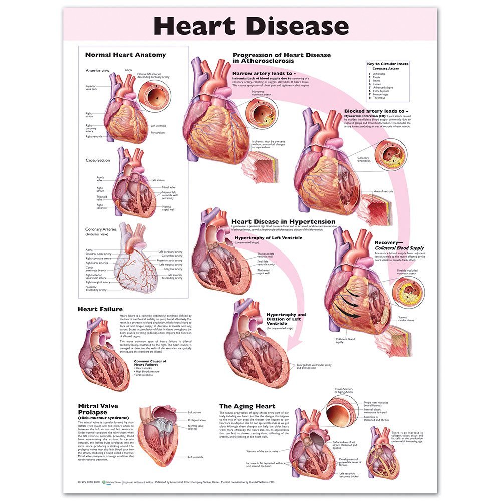 แผ่นโปสเตอร์ Heart Disease Anatomical Chart (Paper) ed 2/2008 กรุณางดสั่งรวมกับหนังสือครับ