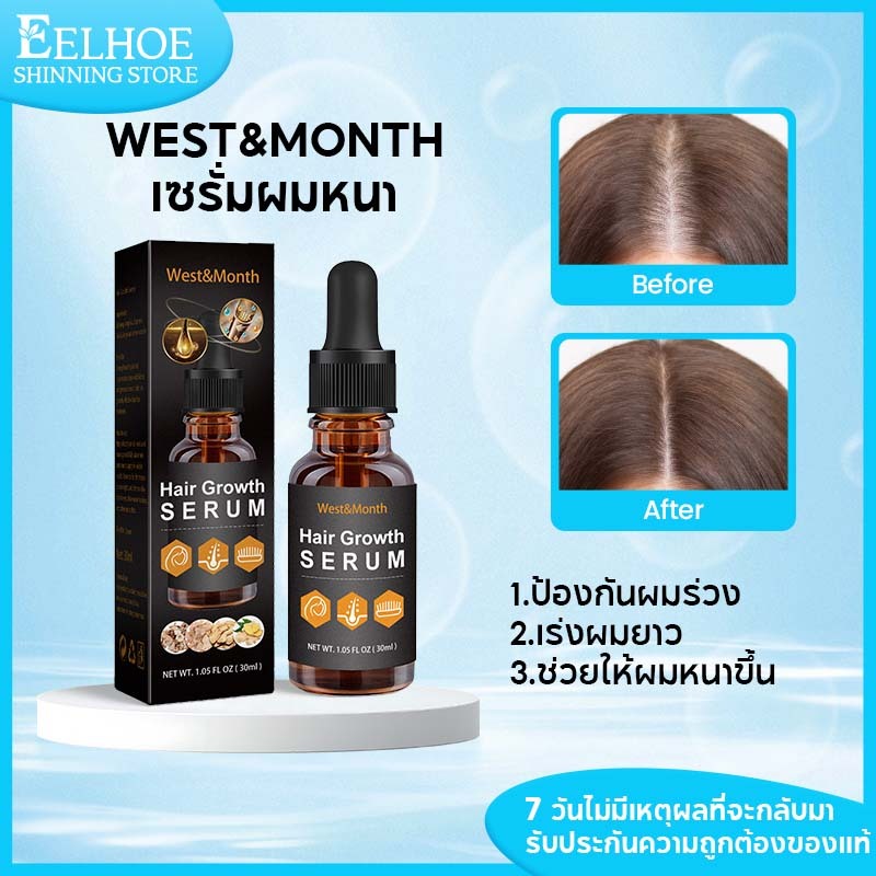 West&Month เซรั่มผมหนา เซรั่มบำรุงผม ป้องกันผมร่วงเร่งผมยาว ตัวบูสแกนผม บำรุงผมเสียช่วยให้ผมนุ่มลื่น