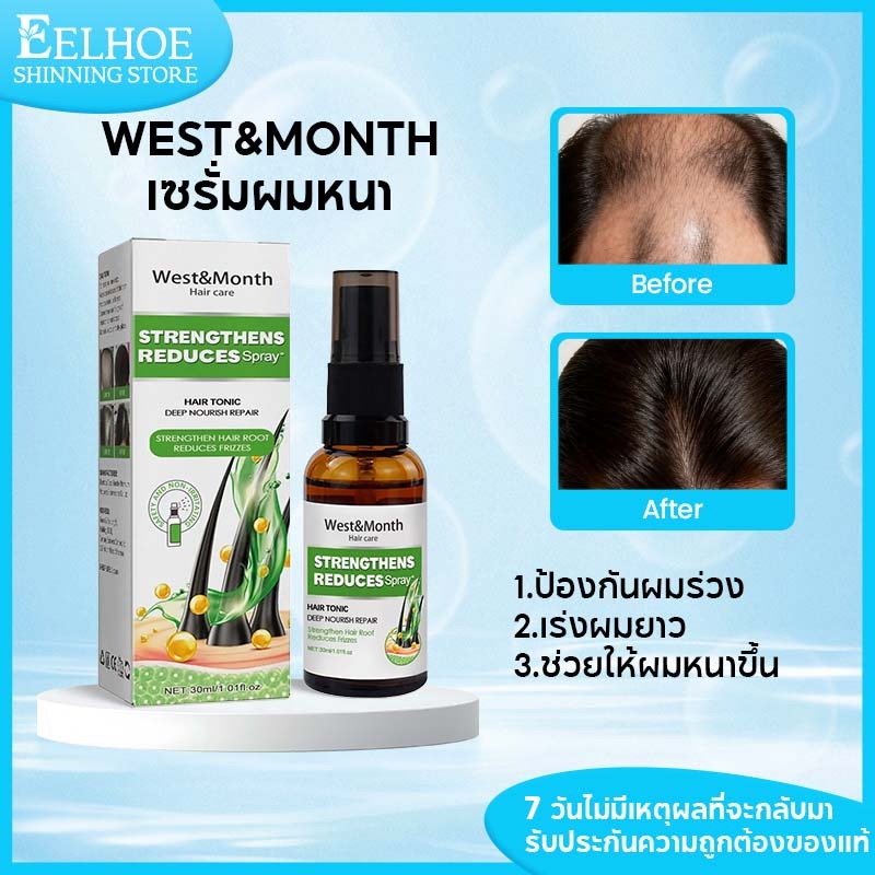 West&Month เซรั่มผมหนา เซรั่มบำรุงผม เซรั่มลดผมร่วงลดการขาดหลุดร่วง ป้องกันผมร่วงเร่งผมยาวบำรุงรากผม