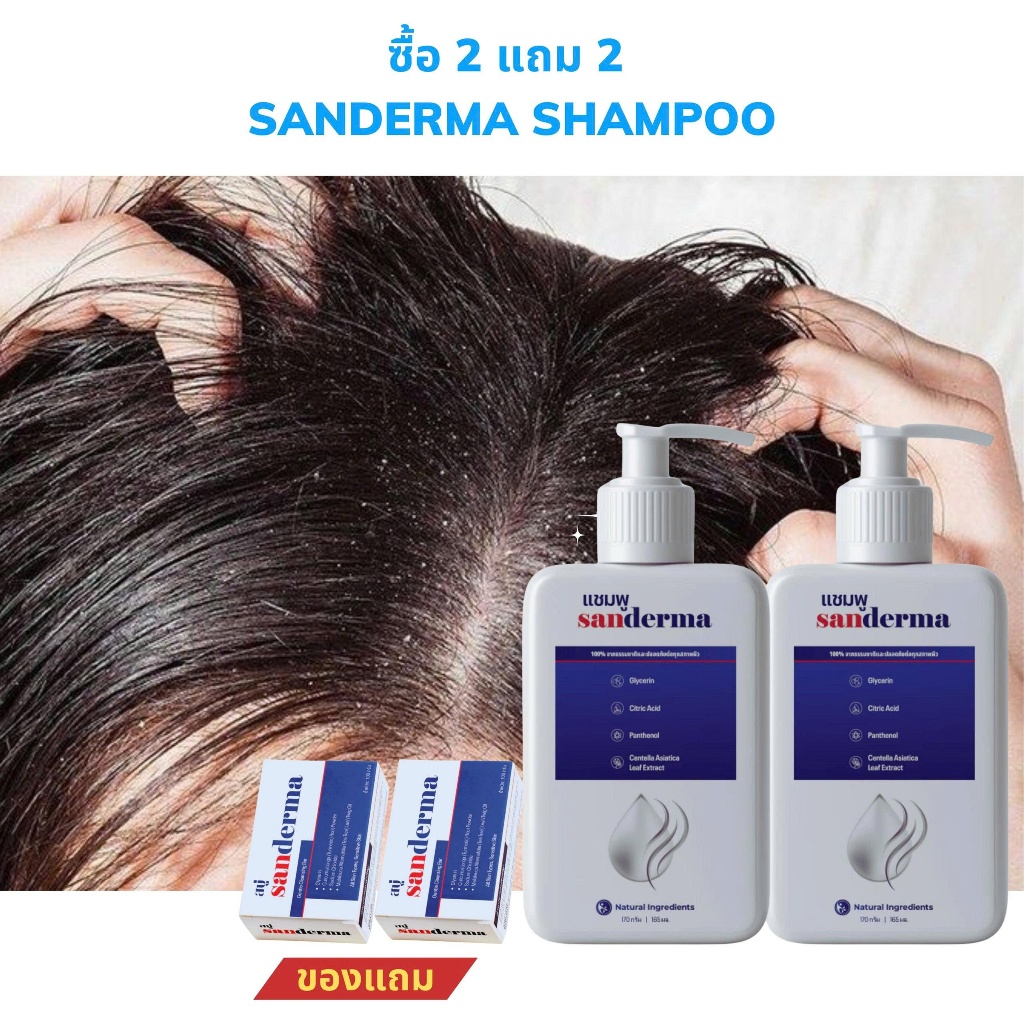 [ซื้อ 2 แถม 2] แชมพู Sanderma แก้เชื้อรา ลดอาการคันหนังศีรษะ ปลอบประโลมหนังศีรษะ 300g