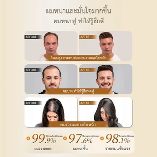 🔥1+1 Care Set🔥 SAFEMILD แชมพูปลูกผม + ครีมนวดผม ลดผมร่วง ปกปิดผมหงอก สมุนไพร บำรุงซ่อมแซมผมเสีย