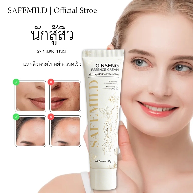 [Acne Saviour]SAFEMILDEssence Cream ช่วยขจัดสิวอย่างอ่อนโยนและยังสามารถใช้กับผิวที่บอบบางได้อีกด้วย🌙