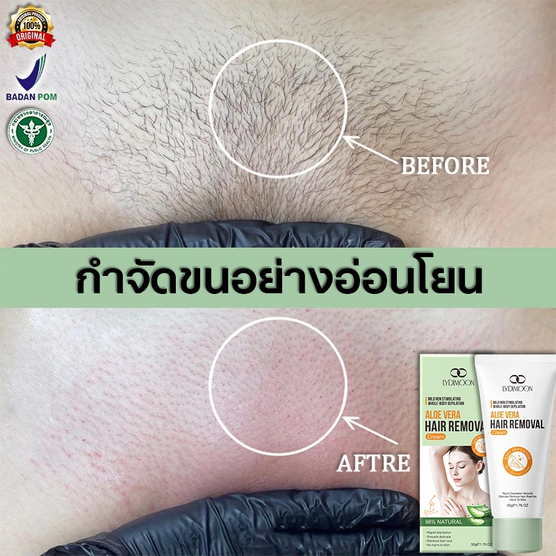 LYDIMOON กำจัดขนน้องสาว ครีมกำจัดขน กําจัดขนน้องสาว 50g อ่อนโยนต่อผิว ไม่มีร่องรอย คนท้องใช้ได้ ชะลอ