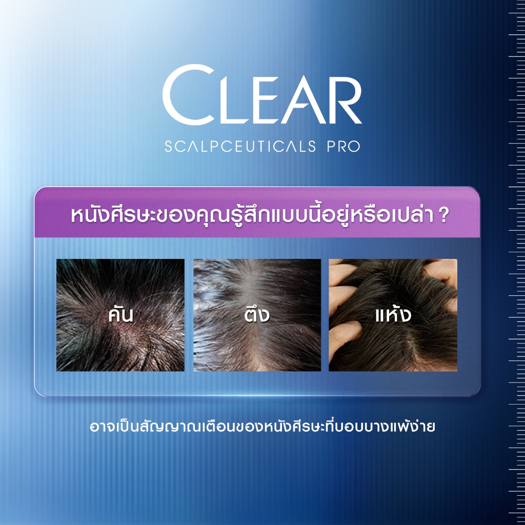 [เซ็ท2ขั้นตอน] เคลียร์ สกาล์ปซูติคอลส์ โปร แชมพูสูตรอ่อนโยน 300มล.+ แชมพูขจัดรังแค 200มล. x1 - รูปที่ 3