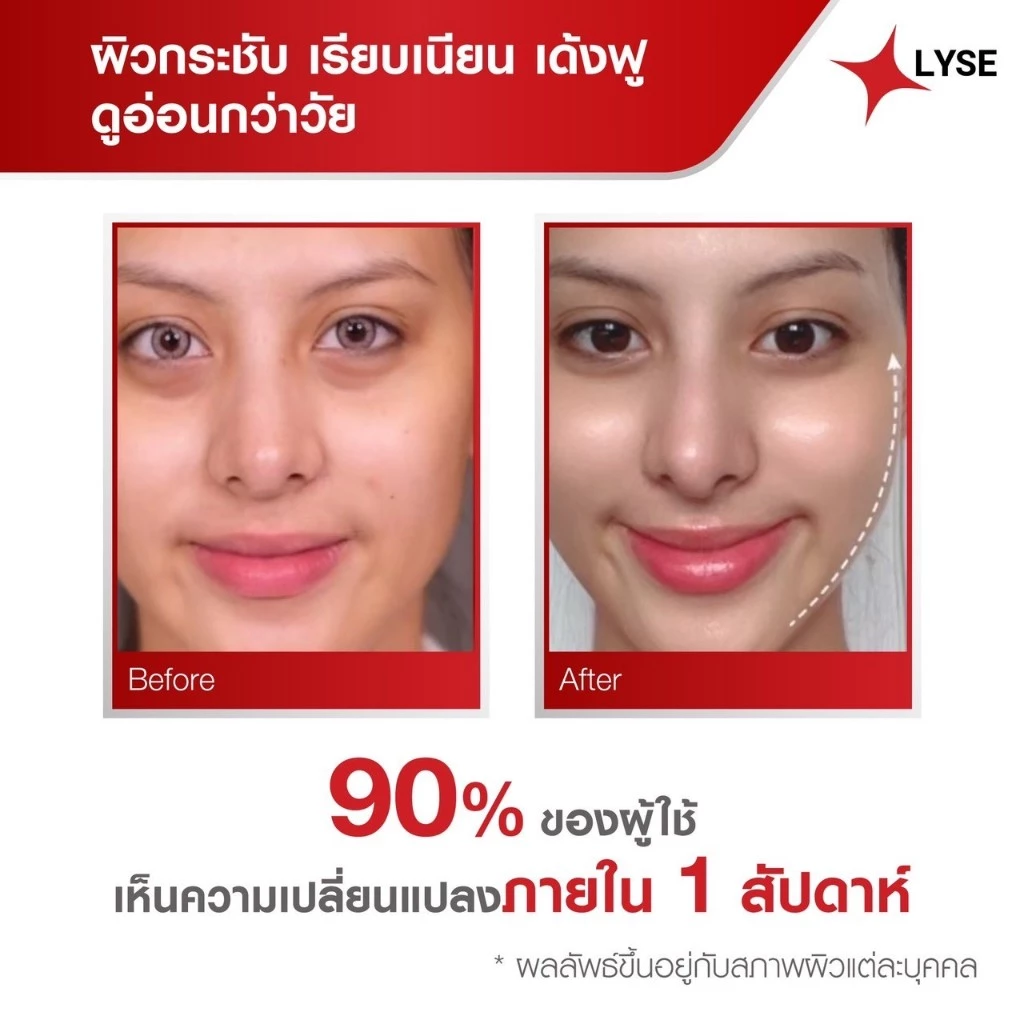 LYSE ครีมฟิลเลอร์ 30 ml และ สบู่อเมทิสต์ 70 g แถมเซรั่มพกพา 10 g thumbnail 3