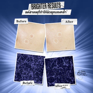 KIEHL'S CLEARLY CORRECTIVE DARK SPOT SOLUTION 30ML เซรั่มลดเลือนจุดด่างดำ ปรับสีผิวให้สม่ำเสมอ และกระจ่างใส