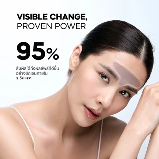 The Awesome Patch XL – กู้ริ้วรอยร่องลึกบนหน้าผาก ร่องคิ้ว แบบเร่งด่วน มาร์กเข็มลดริ้วรอย แผ่นไมโครนีดเดิล 3,800 เข็ม