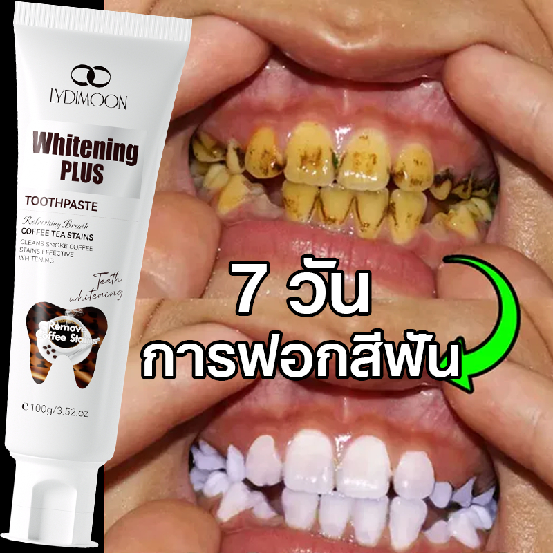 ยาสีฟันฟันขาว ฟอกฟันขาว ยาสีฟันฟอกฟันขาว 120g ฟันขาว ฟอกสีฟัน ลดคราบฟันเหลือง ลดฟันเหลือง ลดหินปูน ลดกลิ่นปาก
