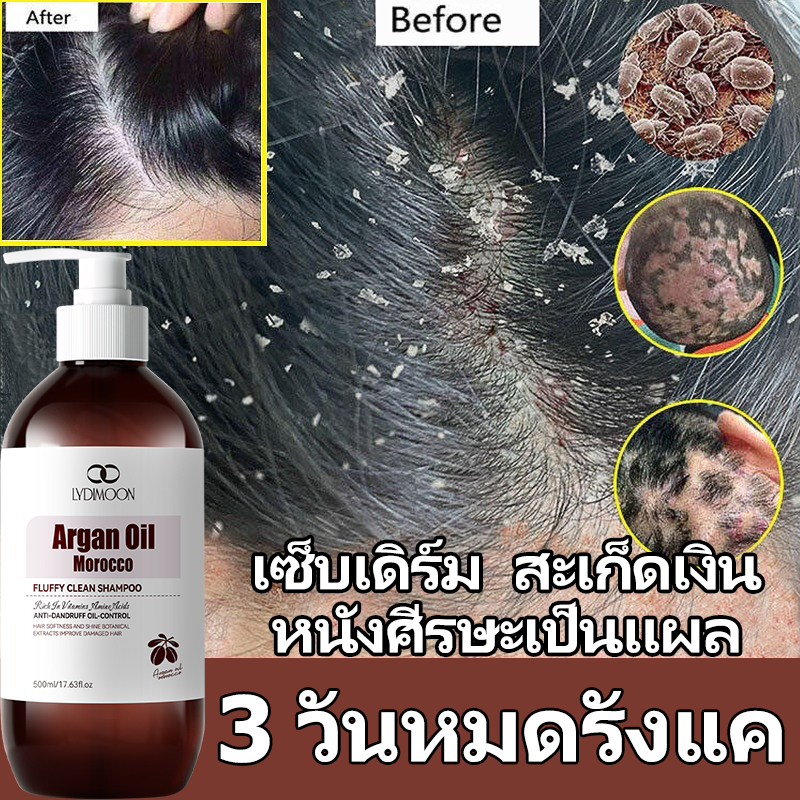 แชมพูแก้คัน ยาสระผมขจัดรังแค แชมพูรังแค 500ml ขจัดรังแค แก้คัน กำจัดไร รักษาเซบเดิร์ม ลดผมร่วง แก้รังแค แชมพู ผมมัน 500g