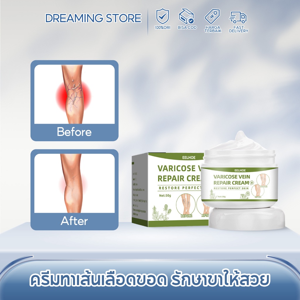 EELHOE ครีมทาเส้นเลือดขอด ครีม รักษาขาให้สวย ขาเนียนเรียบ ผิวขาวใสไร้ที่ติ ส่งเสริมการไหลเวียนโลหิต