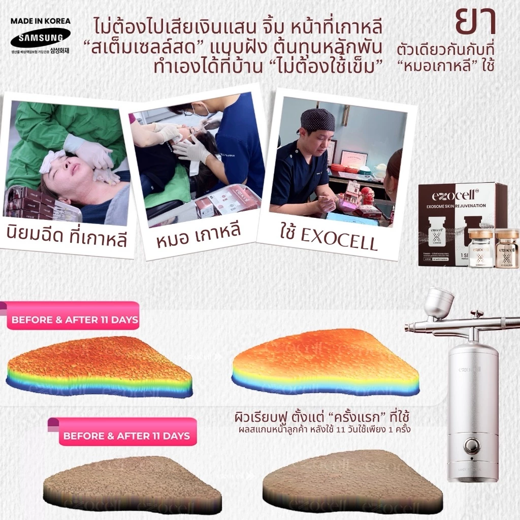 [NANO OXYGEN BOOST] Exocell เครื่องผลัก เซรั่ม แอมพูล exosome สเต็มเซลล์ “ฝังยา” ผิวหน้า , ผม เครื่องพ่นสกินแคร์ thumbnail 6