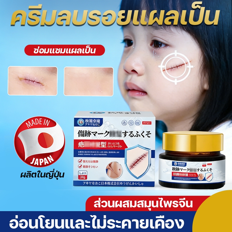 นาโอะ อากิยะ ครีมลบรอยแผลเป็น ลดรอยแผลเป็น ซ่อมแซมรอยแผลเป็น รอยแผลลวก รอยแผลเป็น hyperplasia รอยสิว รอยแตกลาย