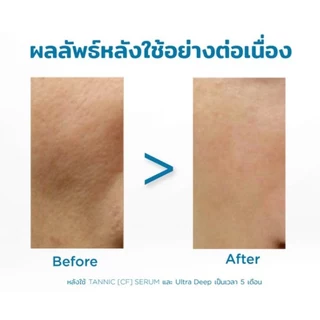 ALPHASCIENCE TANNIC [CF] SERUM เซรั่มวิตซี ลดริ้วรอย หยุดอายุผิว เรียบเนียนกระจ่างใส