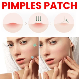 【ซื้อ 4 แถม 1】แปะสิว แปะตราสิว ดูดหนอง สามารถแต่งหน้า หยอกล้อคอนซีลเลอร์ปัดสิวได้ แผ่นแปะสิวดูดหนอง