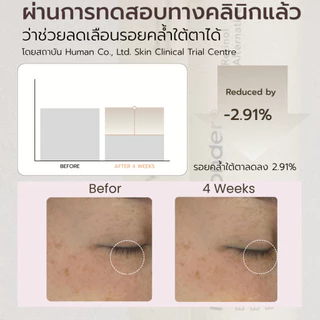haruharu wonder Black Rice Bakuchiol Eye Cream 20 ml.
