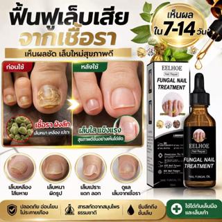 น้ำยาบำรุงเล็บ สูตรพืชธรรมชาติ บำรุงเล็บเสีย ป้องกันเล็บเหลื…