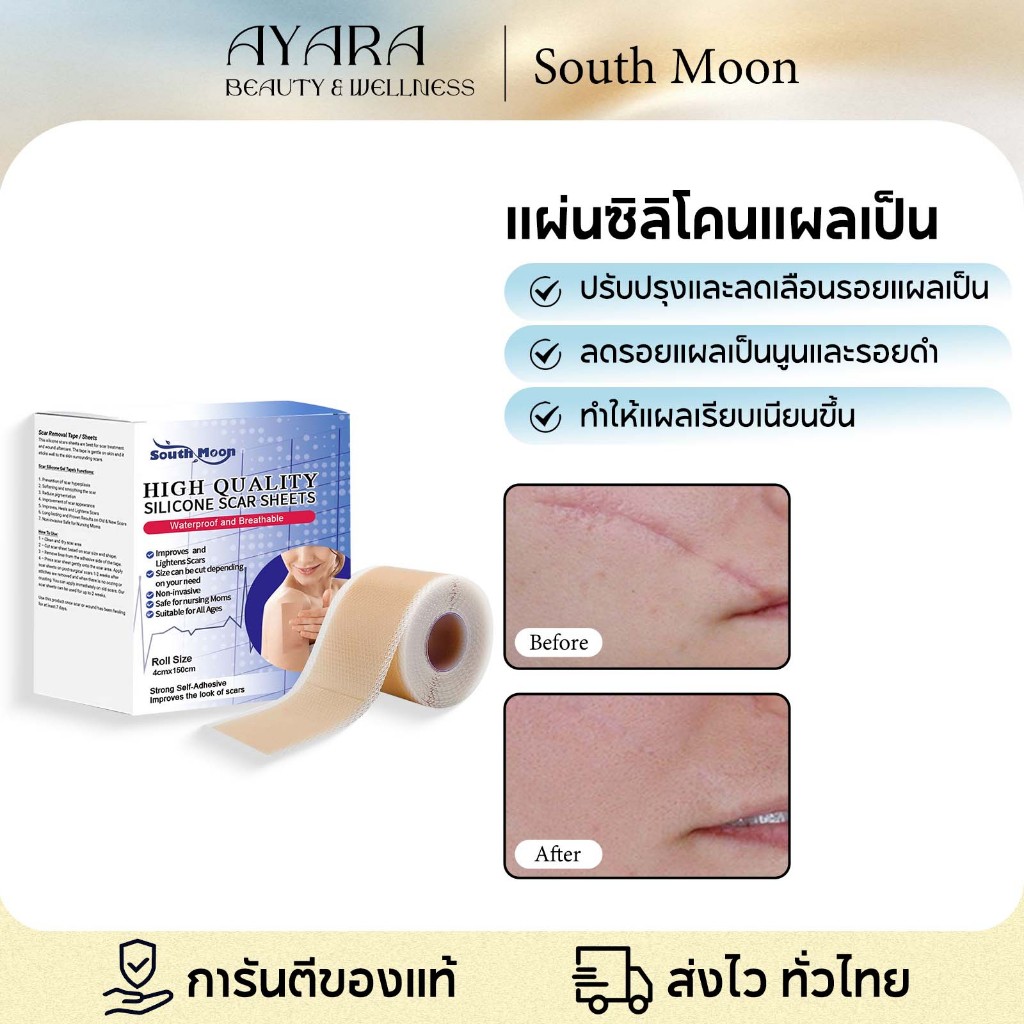South Moon ซิลิโคนแปะแผลเป็น แผ่นแปะลดรอยแผลเป็น รักษารอยแผลเป็น แผ่นแปะซิลิโคนดูแลแผลเป็นนูน แผลเป็