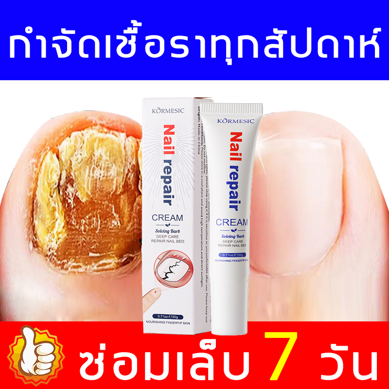 ✨ฟื้นฟูเล็บ✨ ครีมทารักษาเชื้อราเล็บ ครีมบำรุงเล็บ ช่วยฟื้นฟูเล็บที่เปราะบาง ทำให้เล็บแข็งแรงและดูสุขภาพดี ซึมไว ใช้ง่าย
