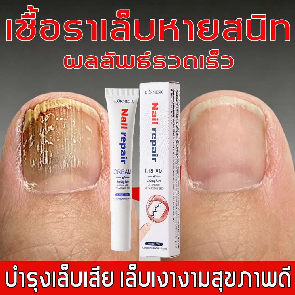 ยาทาเล็บ รักษาเชื้อราเล็บ บำรุงและซ่อมแซมเล็บที่เสียหาย ส่วนผสมอ่อนโยน เหมาะสำหรับเล็บมือและเล็บเท้า
