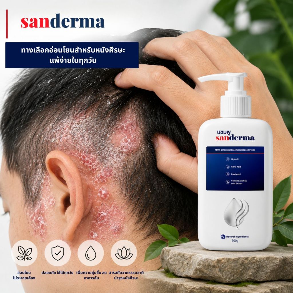 แชมพูสมุนไพร Sanderma 300 กรัม – อ่อนโยนสำหรับหนังศีรษะแพ้ง่าย ช่วยลดอาการคันและปรับสมดุลความชุ่มชื้