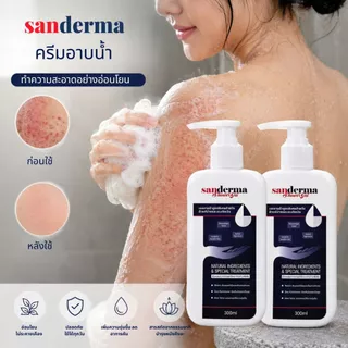 [Best Seller] เซตสบู่อาบน้ำ Sanderma 300 มล. 2 ขวด – เหมาะสำหรับผิวขนคุดและสิวหลัง