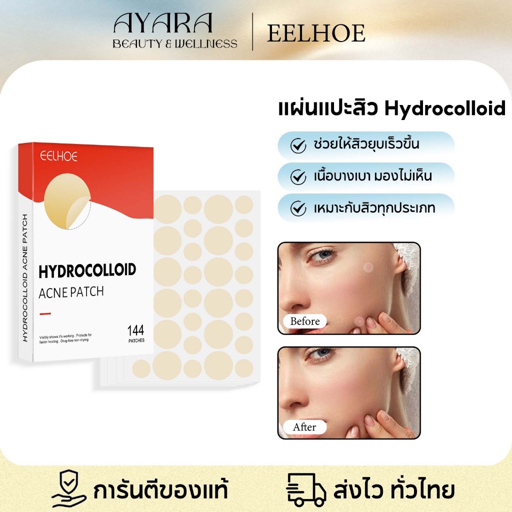 EELHOE แผ่นสิว แผ่นแปะสิว แผ่นแพทช์แปะรักษาสิว แผ่นดูดสิว ช่วยลดอาการอักเสบให้ยุบไว กันน้ํา ระบายอากาศ แผ่นแปะดูดซับสิว